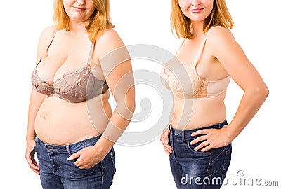 Woman before and after weight loss Stock Photo