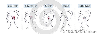A womans head with different categories of hearing aids for the hearing impaired and the deaf.Vector flat illustration. Vector Illustration
