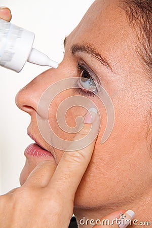 Women with allergies Stock Photo