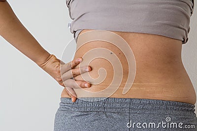 Women fat belly fat with stretch marks Stock Photo