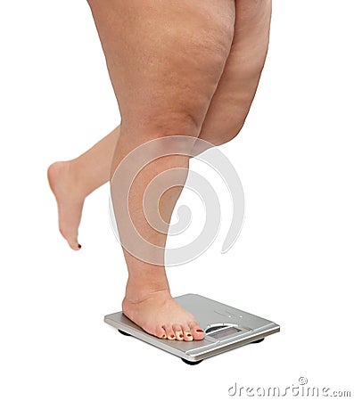 Women legs with overweight Stock Photo