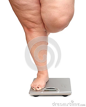 Women legs with overweight Stock Photo