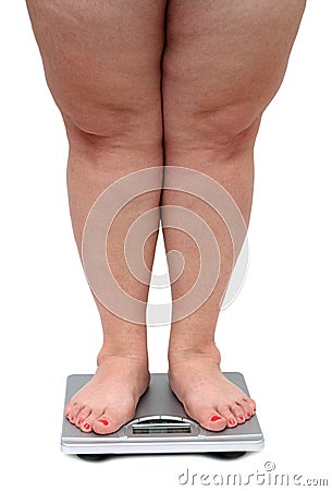 Women legs with overweight Stock Photo