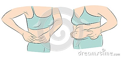 Women with and without stomach. losing weight. excess weight. vector illustration. Vector Illustration