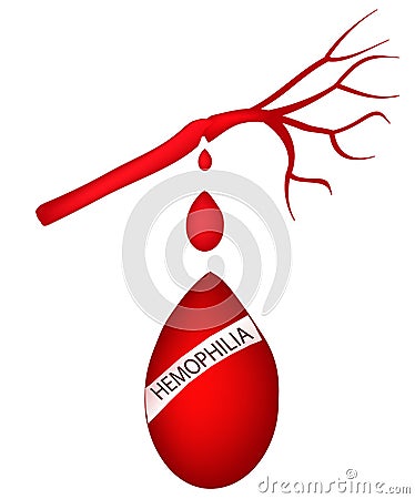 World Hemophilia Day. 17 April. A drop of blood flowing from the artery. Vector illustration Vector Illustration