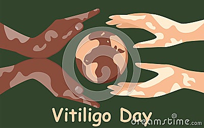 World Vitiligo Day poster. Hands of different nationalities with skin diseases. Human solidarity. Vector Illustration