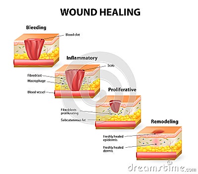 Wound healing Vector Illustration