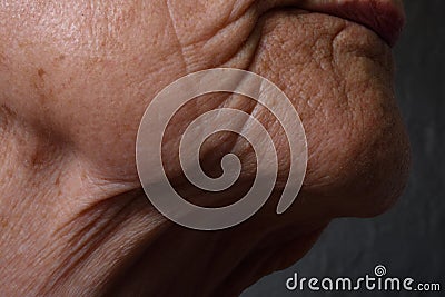 Wrinkles Stock Photo