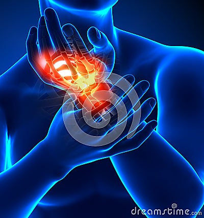 Wrist pain - detail Stock Photo