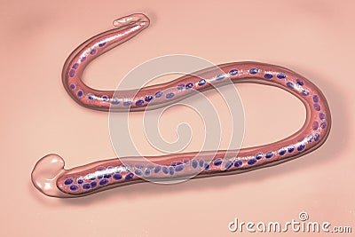 Wuchereria bancrofti, a roundworm nematode, one of the causative agents of lymphatic filariasis Cartoon Illustration