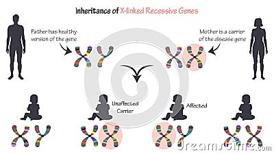 x-linked inheritance of recessive genes infographic diagram Cartoon Illustration