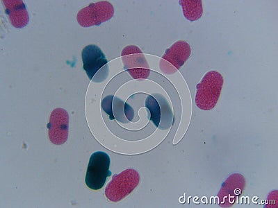 Pea Pollen 400x Pink and Blue Stock Photo