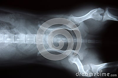 x-ray Stock Photo