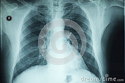 X RAY BODY PARTS Stock Photo