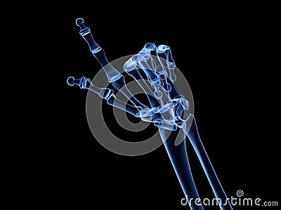 X-ray hand - arthritis Cartoon Illustration