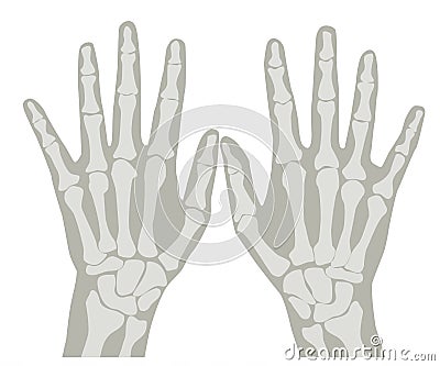 X-Ray Hands 1 Stock Photo