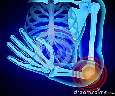 X-ray of the human hand. Anatomy of the shoulder girdle and arm. Cartoon Illustration