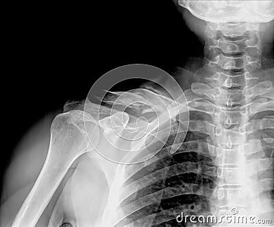 X-ray Stock Photo