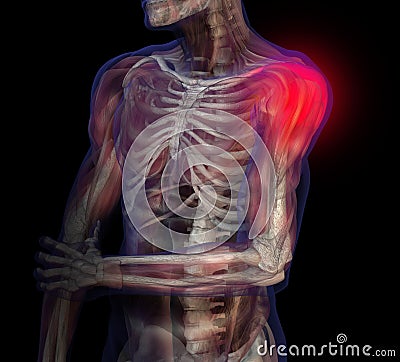 X-ray illustration of shoulder pain. Cartoon Illustration