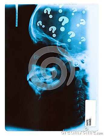 X-ray image Stock Photo