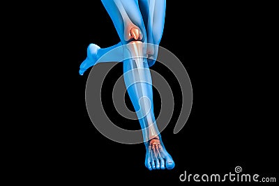 x-ray image of a pair of legs Stock Photo