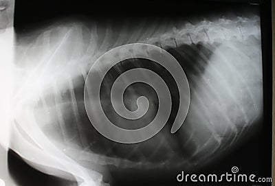 X-ray image of thorax with tumor Stock Photo