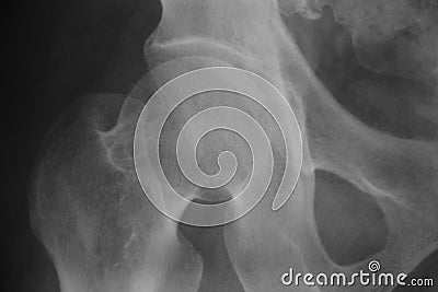 X-ray images Stock Photo