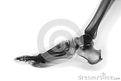 X-ray normal human foot . Lateral view . Invert color style Stock Photo