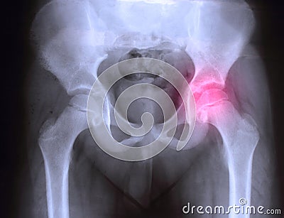 X-ray Stock Photo