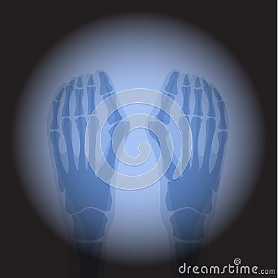 X Ray radiology. Vector Illustration