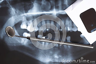 X-ray scan of humans teeth Stock Photo