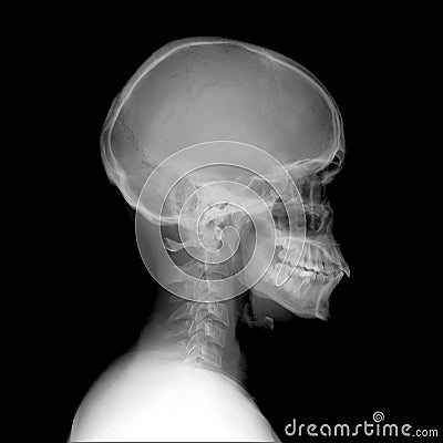 X-ray skull and cervical spine. Sagital view normal. Stock Photo