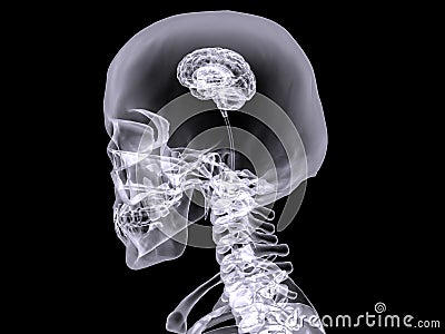 X-ray small brain Stock Photo