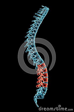 X-ray spinal column with lordosis posture and pathological vertebrae highlighted in red. Human curvature of the spine disorder 3D Cartoon Illustration