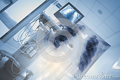 X-ray unit with chest image in hospital Stock Photo