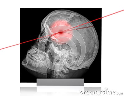 X-rays-3 Stock Photo