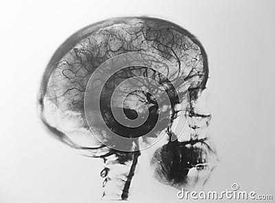 X-rays head Stock Photo