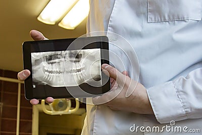 X-rays of teeth Stock Photo