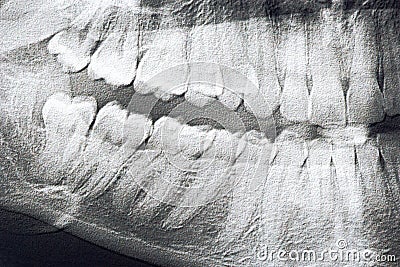 X-rays teeth Stock Photo