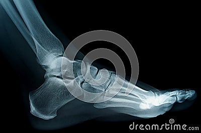 Xray Stock Photo