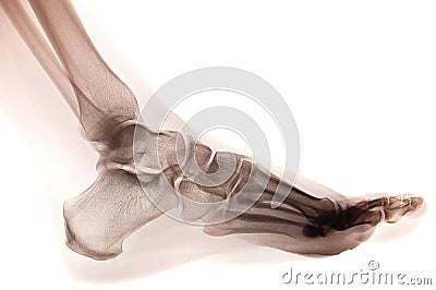 Xray Stock Photo