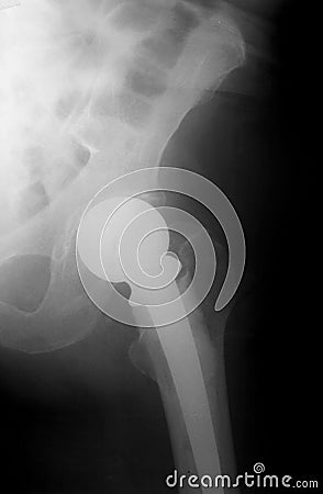 Xray Stock Photo