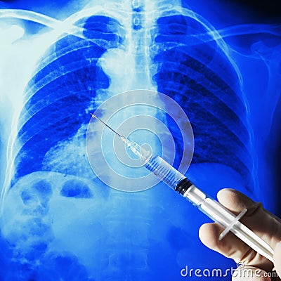 Xray ct chest film syringe Stock Photo