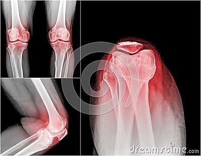 Xray Stock Photo