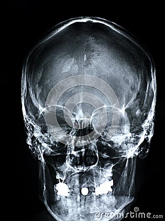 Xray/Face front Stock Photo