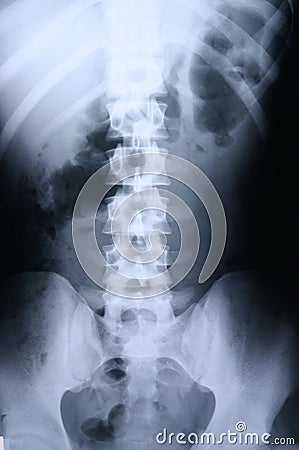 Xray/spine 1 Stock Photo