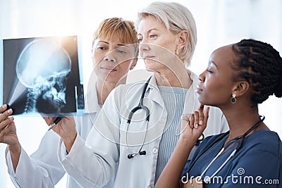 Xray, women doctors and radiology team planning for test, results charts and healthcare analysis advice. Medical group Stock Photo