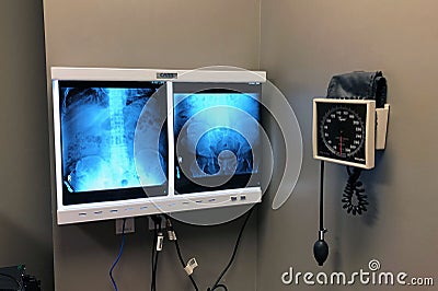 Medical XRays In A Doctors Office. Editorial Stock Photo