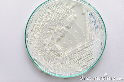 Yeast in petri dish for education in laboratories. Stock Photo