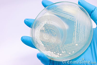 Yeast in petri dish, Microbiology for education. Stock Photo
